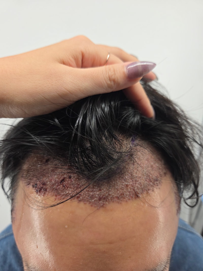 2천모낭 1달 후기 입니다.