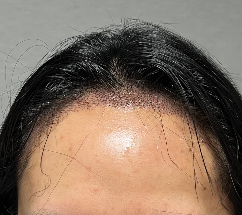 압구정 모우림의원 여자 후기입니다