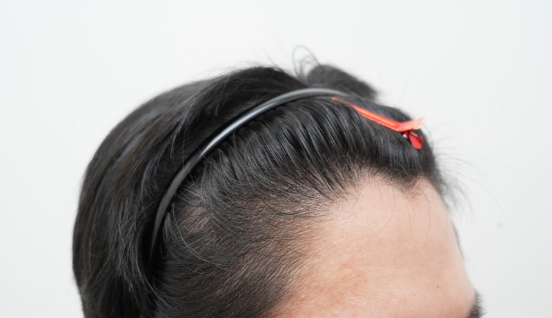 [연세모나의원]30대 남자입니다 희망이 보입니다