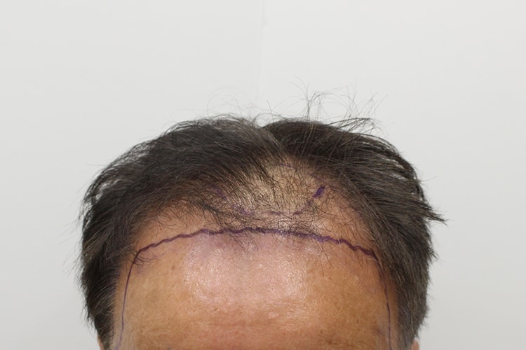 대전 리즈모에서 심었습니다 2주 되어 후기 적어봅니다