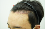176560cd4b40af9a10353e78aa37d0f0_1773896139_7093.png