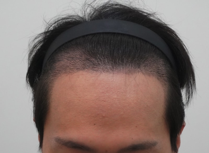 940c44e58cd79cdd8fe213cc886f2e36_1772516322_2472.JPG