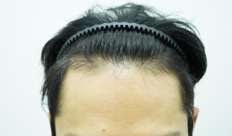 ae346baef4b1581b8046b2d6c517eca0_1773817686_781.png ae346baef4b1581b8046b2d6c517eca0_1773817686_781.png