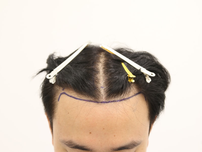 포토후기 이미지