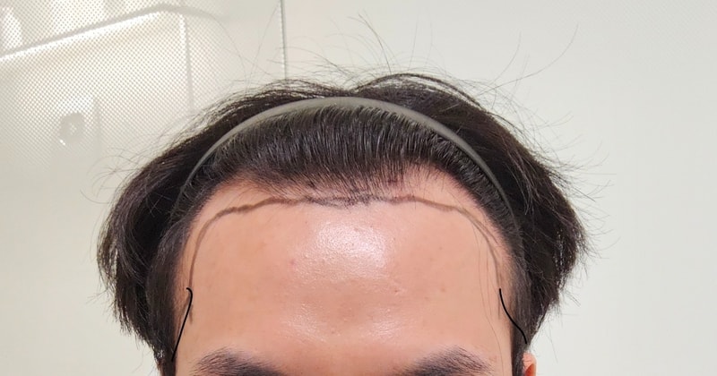 포토후기 이미지