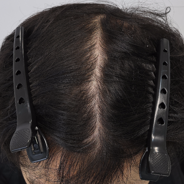 포토후기 이미지