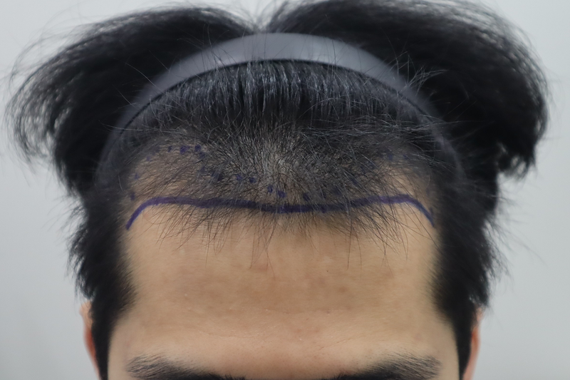 6dd58f239351f77b7d5fe1ce1328cd21_1778113153_5688.png
