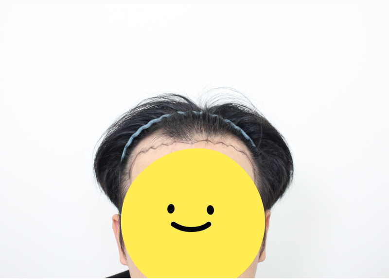 포토후기 이미지