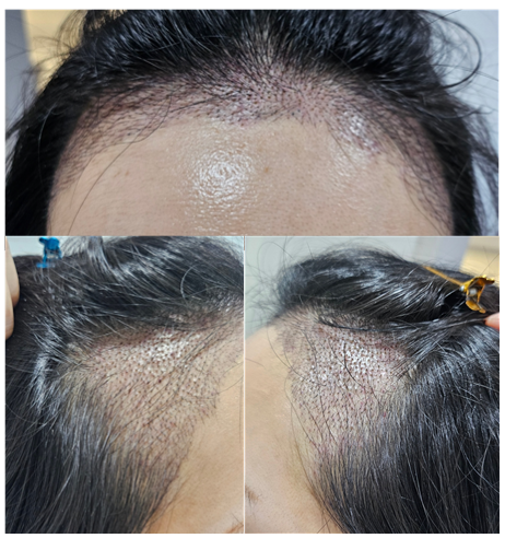 포토후기 이미지