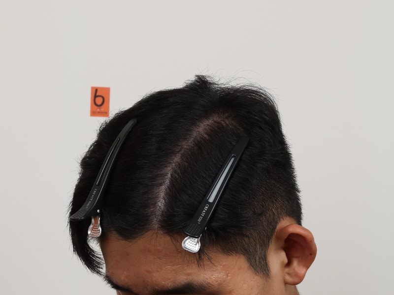 856fc9d53b0ae0b5de6ac59dbb594c26_1780302824_9448.jpg