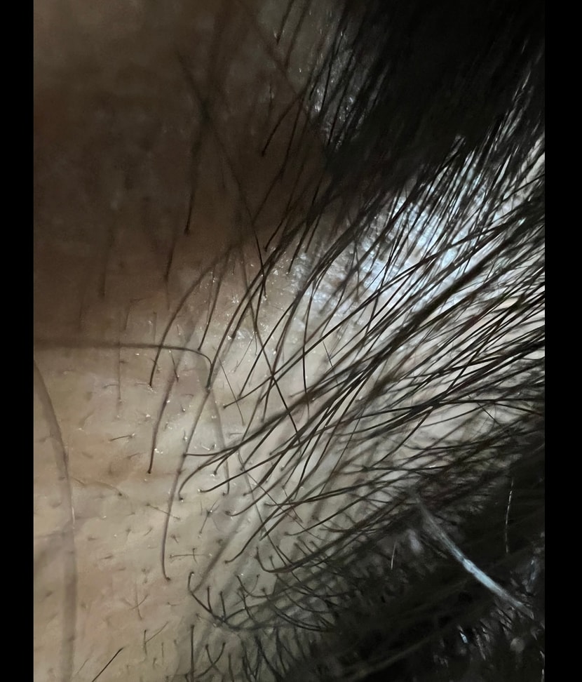 앞머리 위로 올리고 접사한 사진이야… 솜털같이 생긴 친구들 살릴 수 있어..?