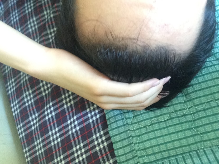 이건 정면