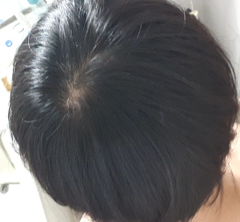 윗 사진이랑 같은 상태에서 뒤에서 찍은 사진