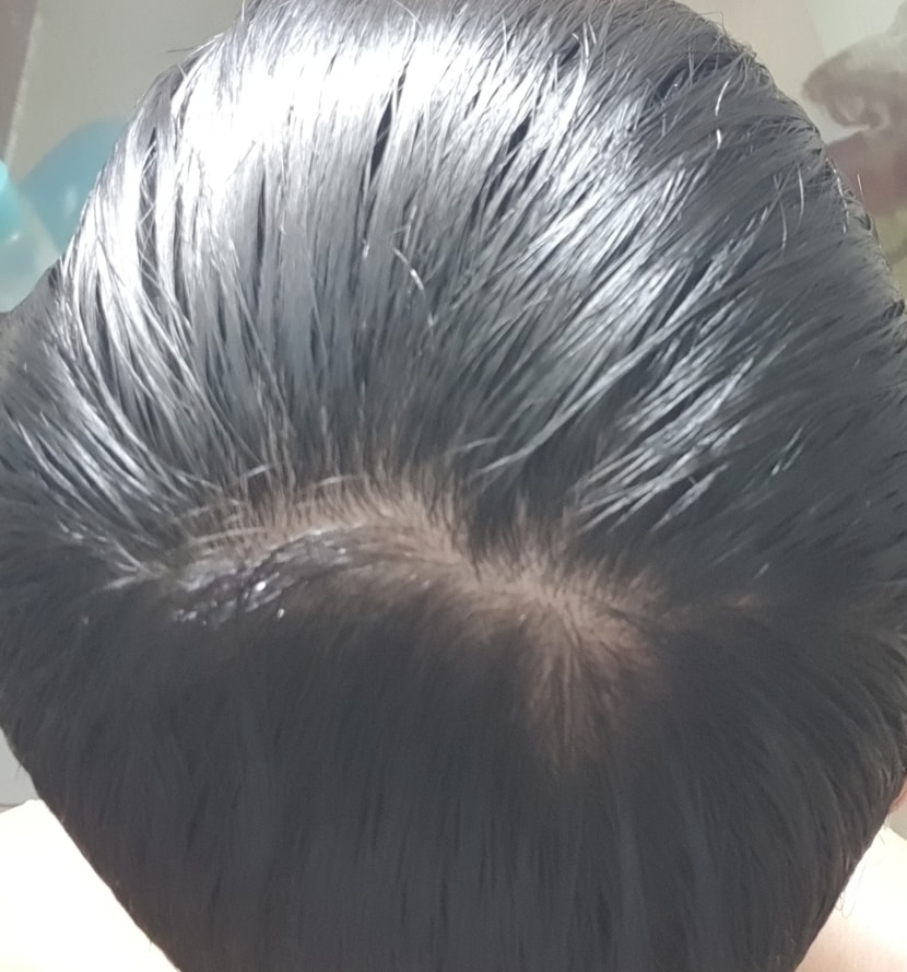 샴푸하기전 물 뭍혀서 내린상태