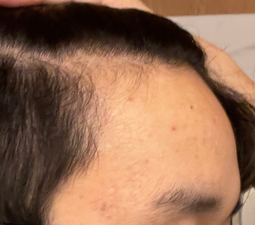 현재 R