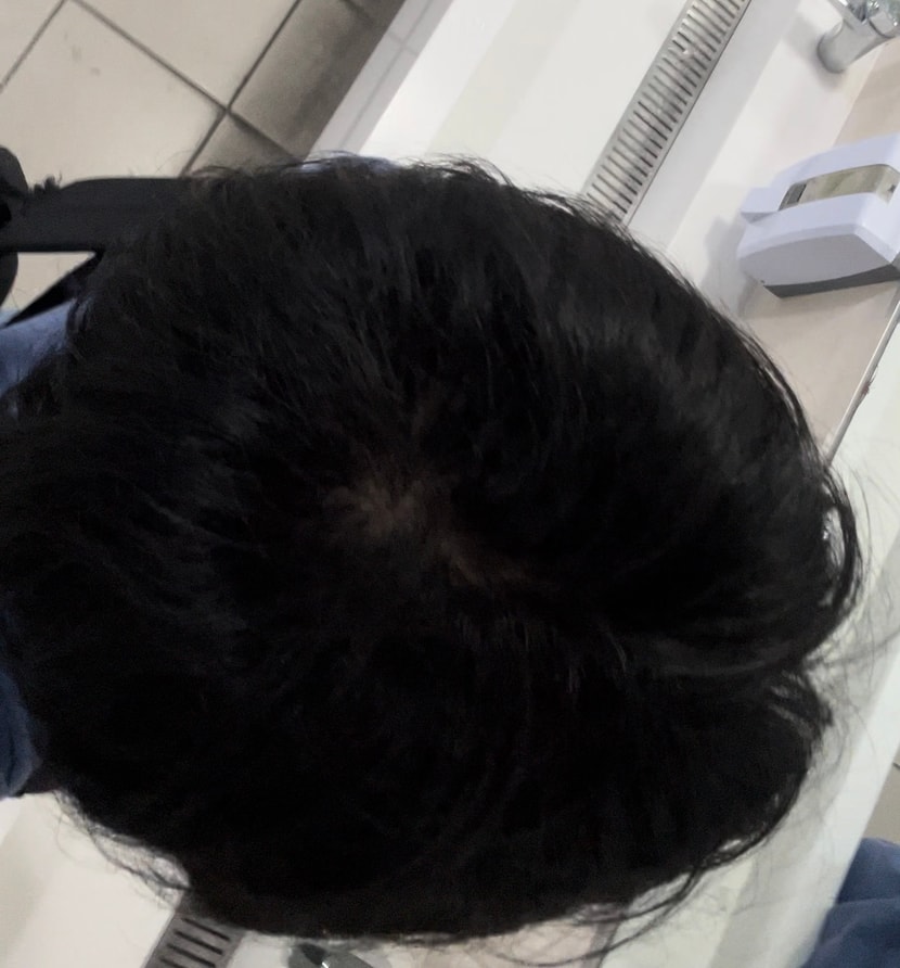 조명 약한곳