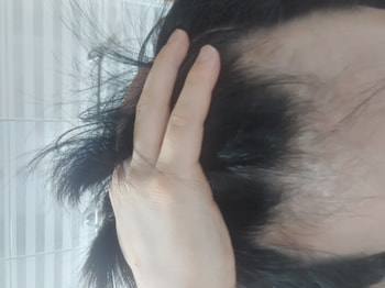ㆍ