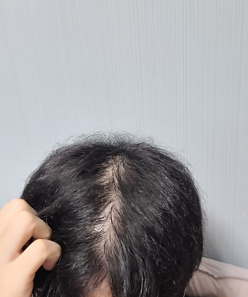 가르마가 너무 걱정이다..미용사도 놀라던데