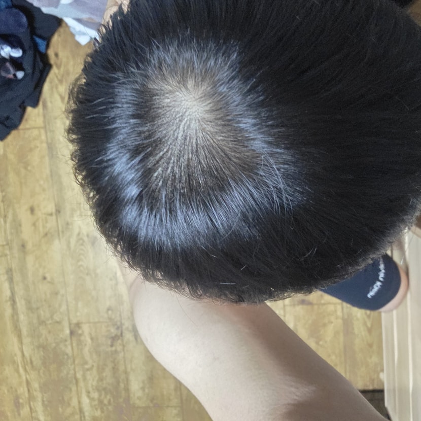 머리말린후