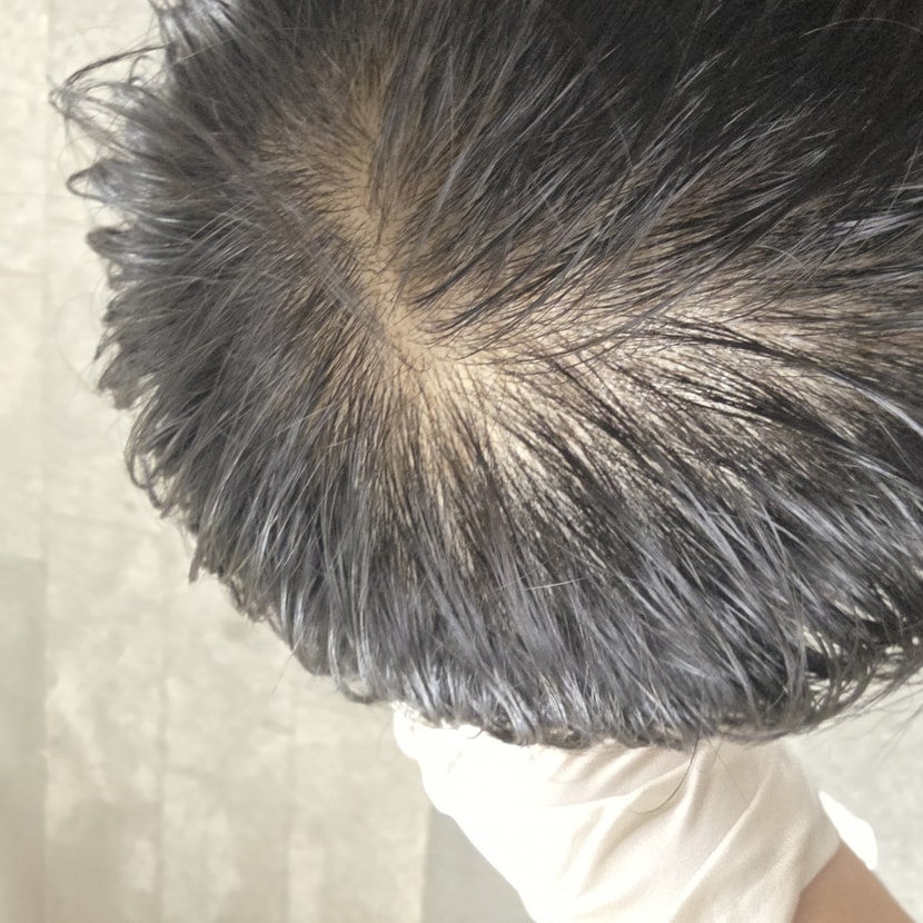 머리 젖었을때