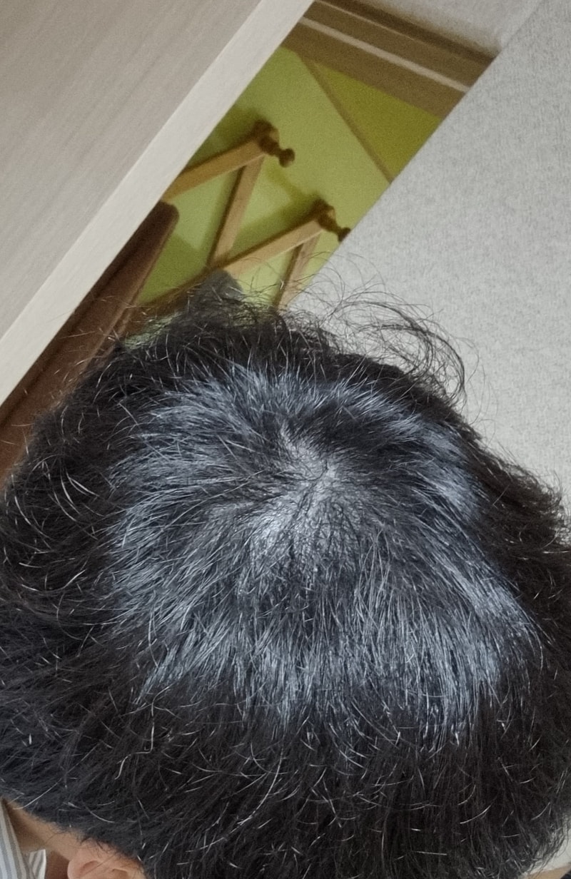 髪の毛がなさすぎて帽子をかぶらないわけにはいかない..ㅠ..