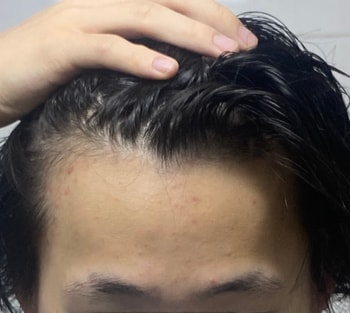 지금왼쪽