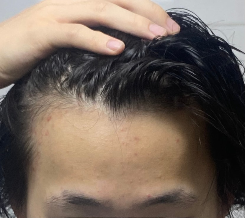 지금왼쪽