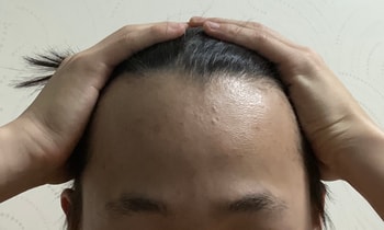 3년 전
