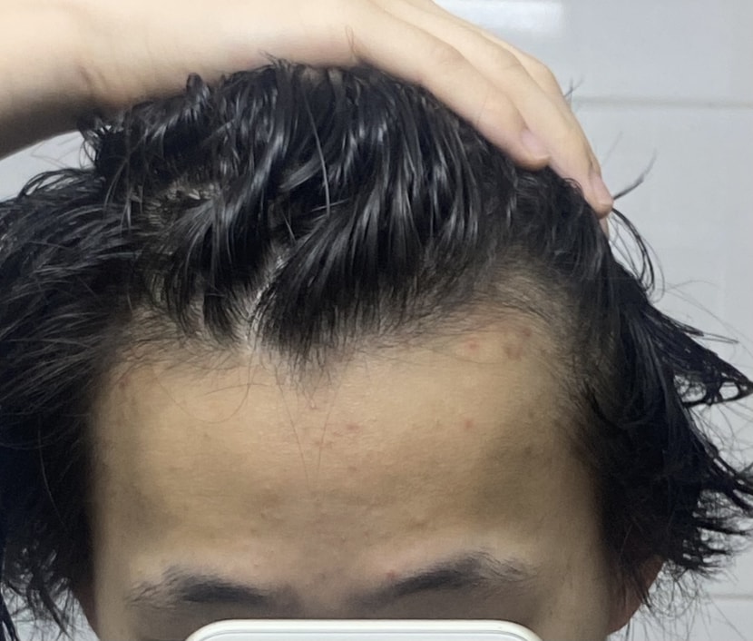 지금오른쪽