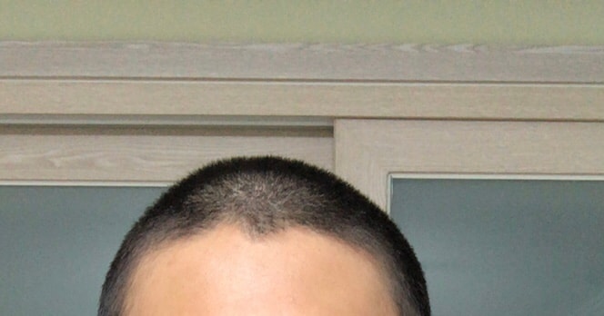 군대 갈라고 머리 밀었는데..