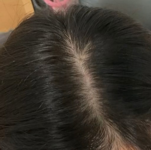 오늘 사진(약간 그림자)