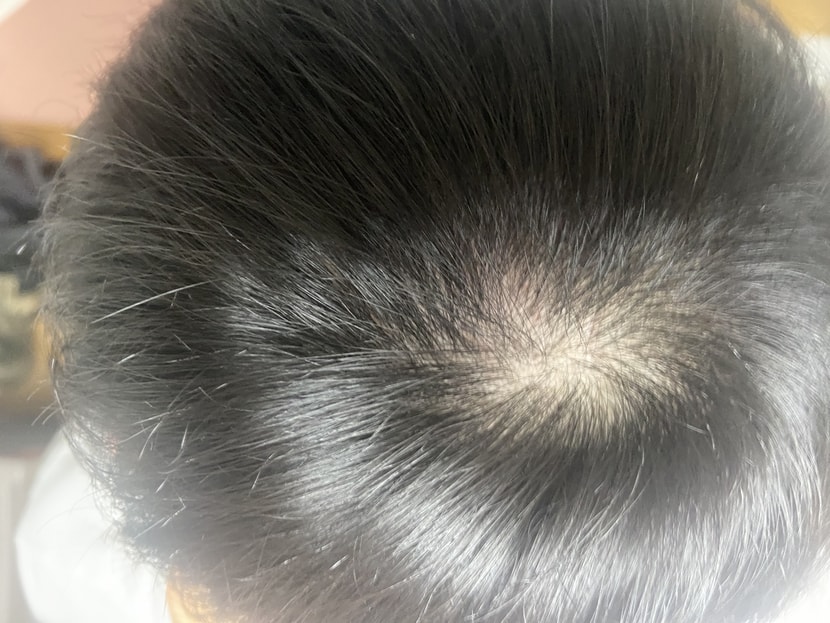 약 복용 1달