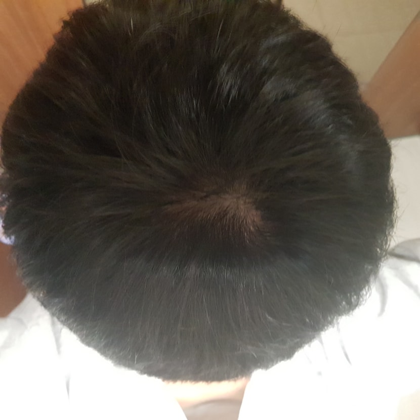 조명x