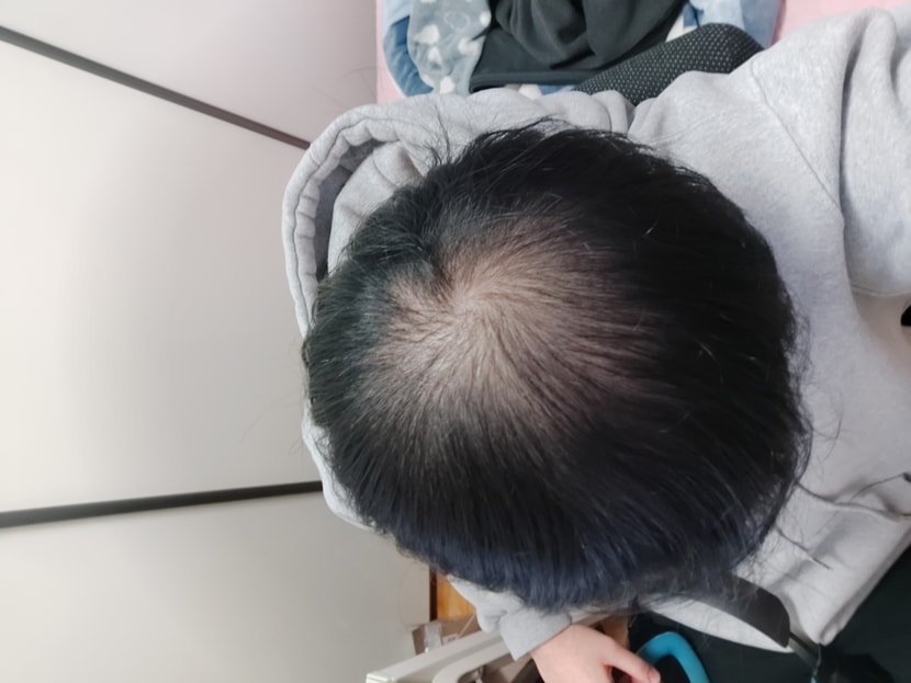 10개월 정도 약 복용함..