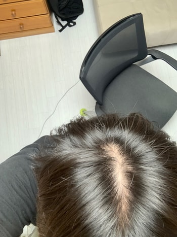 정수리