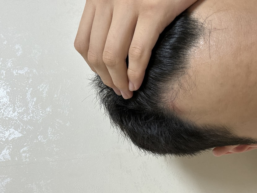 오른쪽