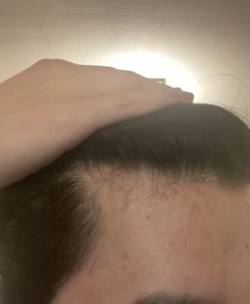 m자라인 왼쪽 오른쪽인데 많이 심한가요?