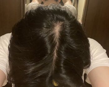 정수리부분이랑