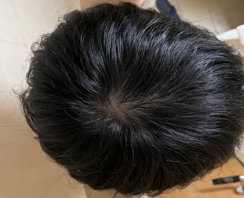 빛 아래에서 찍었을때
