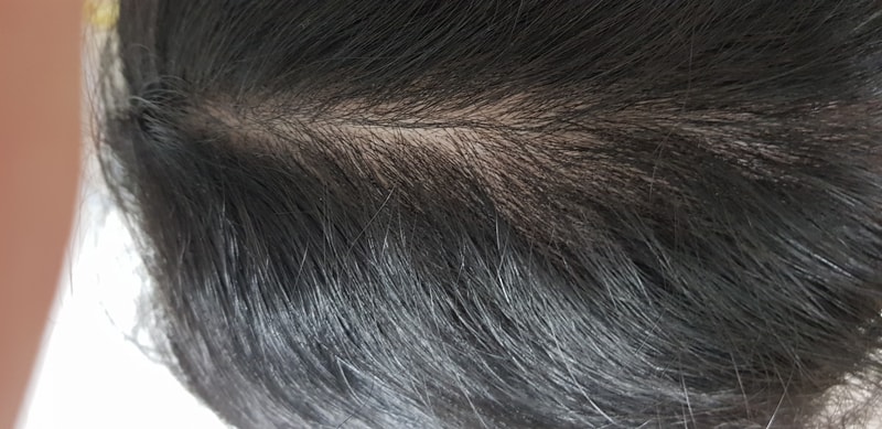 하시... 회생 가능할까...