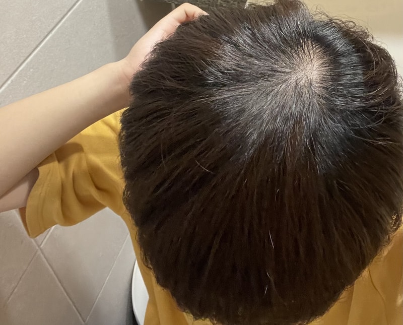 조명밑에 이정도면 많이심해??