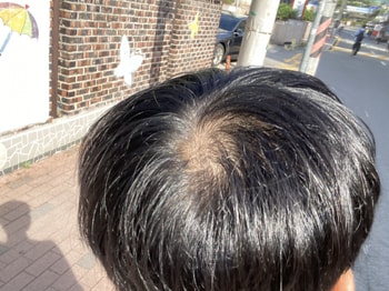 햇빛 받을때 찍음
