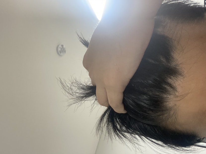 앞