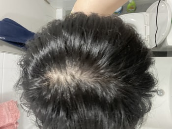 정수리