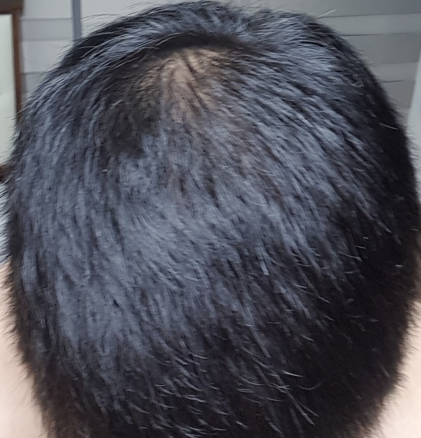 20191022, 복용 약 1개월차