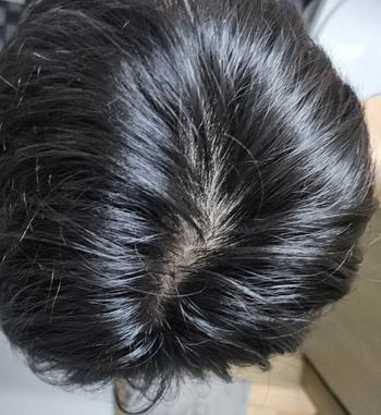 정수리 그냥 윘머리 다 벗겨지는 느낌