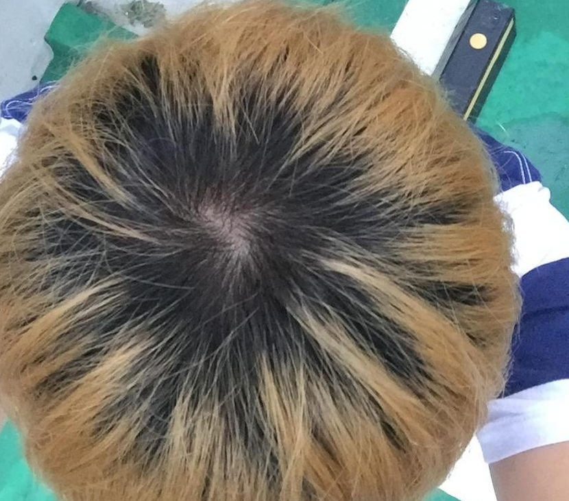ㅇㅇ