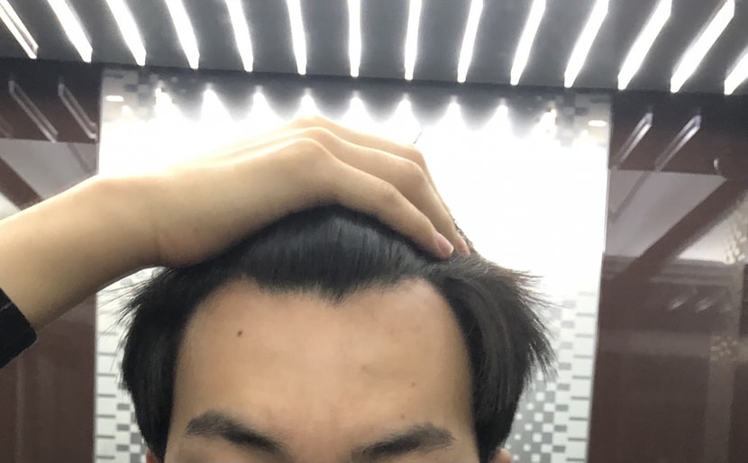 정면샷2