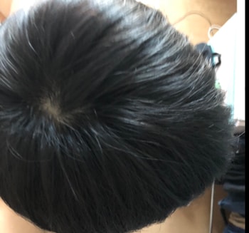 정수리