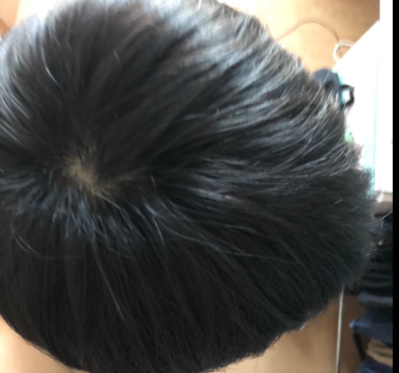 정수리